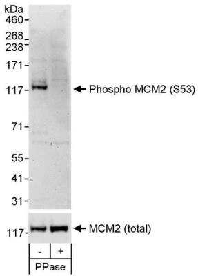 Western Blot: MCM2 [p Ser53] Antibody [NB100-2339]
